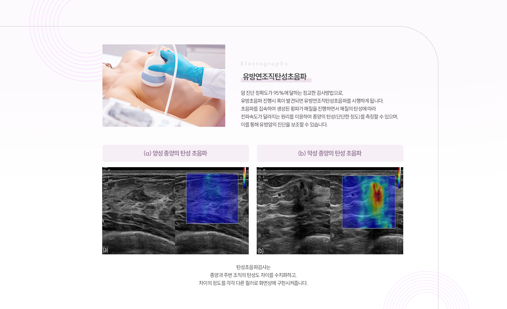 유방/갑상선초음파 상세04