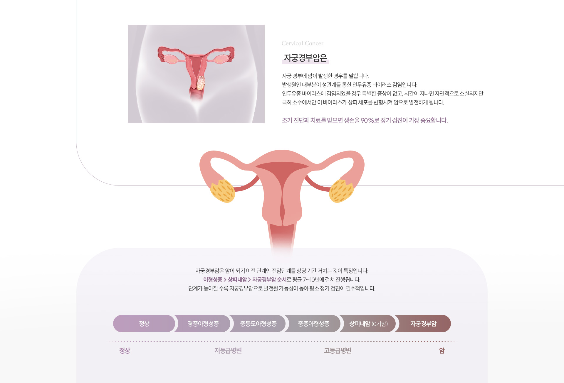 자궁경부암 상세01