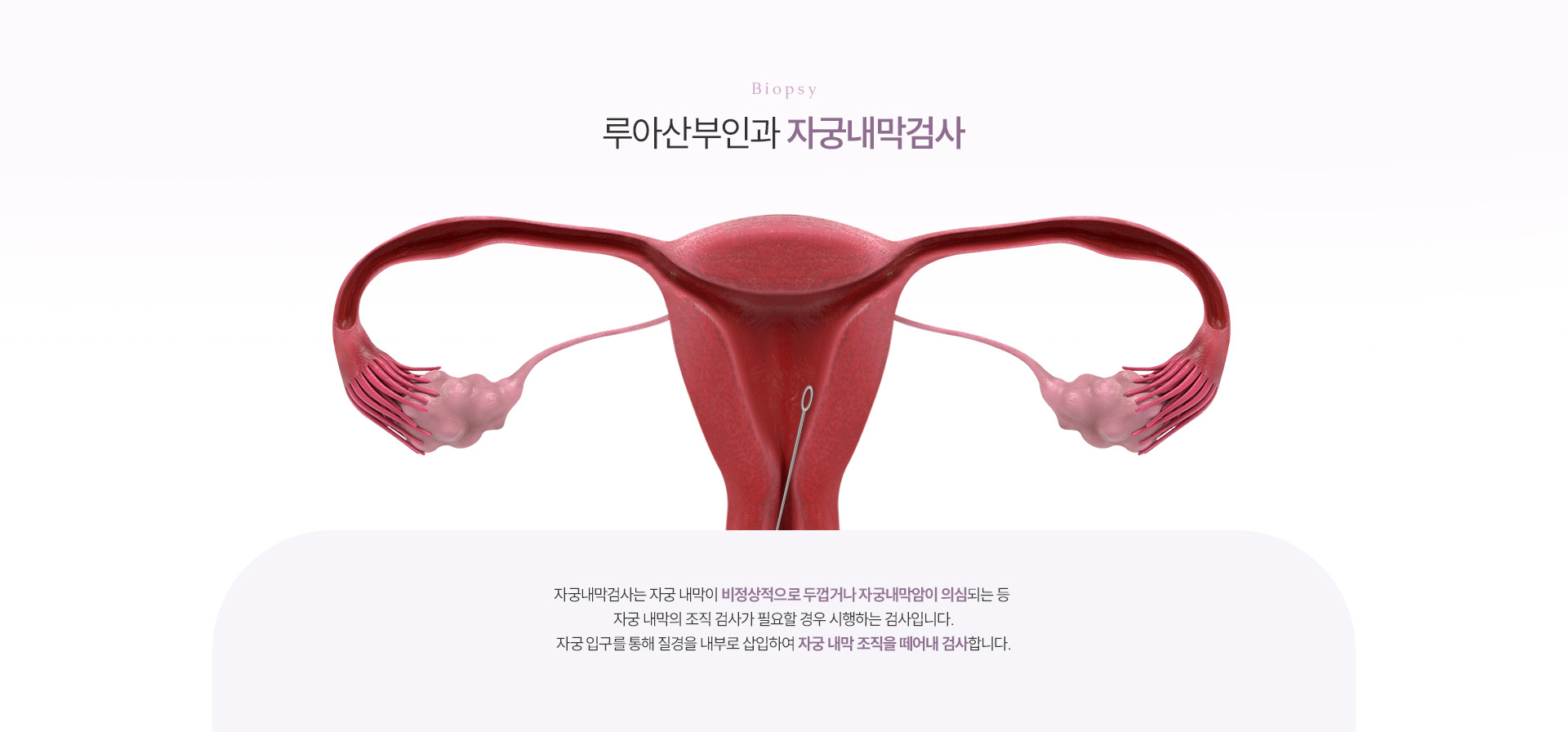 자궁내막검사 상세02