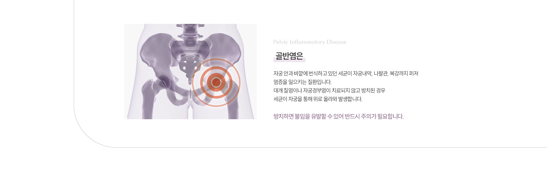 골반염 상세01