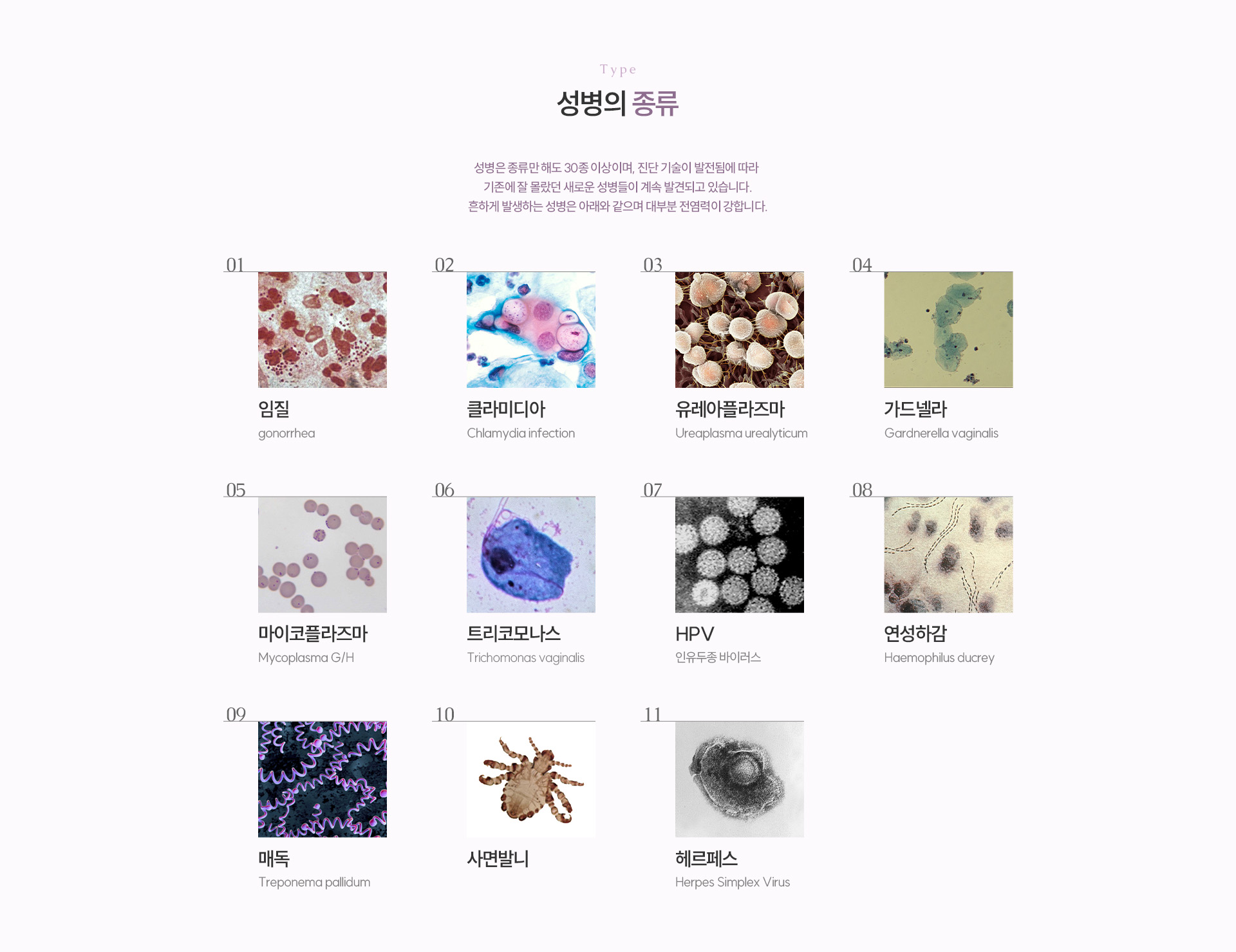 성병 상세02